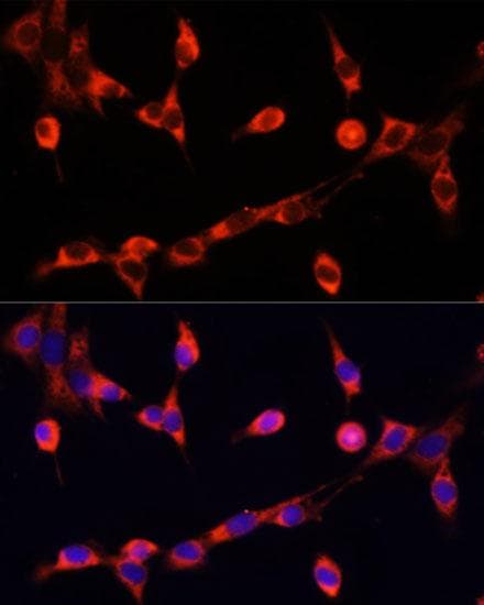 CHAT Antibody