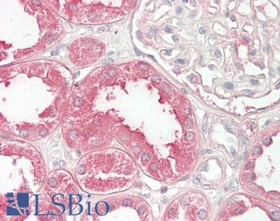 IHC-plus™ NGN / Neogenin Antibody (aa1411-1461)