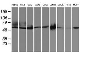 CCM2 / Malcavernin Antibody (clone OTI1E9)