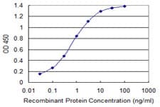 RAB1B Antibody (clone 1B2)
