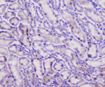 Properdin / CFP Antibody