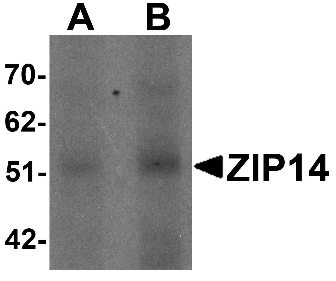 IHC-plus™ Polyclonal Rabbit anti-Human SLC39A14 / ZIP14 Antibody (IHC, IF, WB)