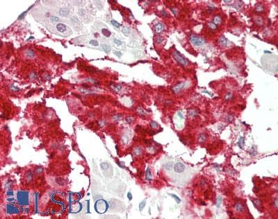 Polyclonal Rabbit anti-Mouse RAPGEF2 Antibody (FITC, aa1274-1323, IHC, WB)