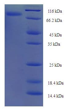Human NXPE3 / FAM55C Protein (Recombinant His-SUMO)