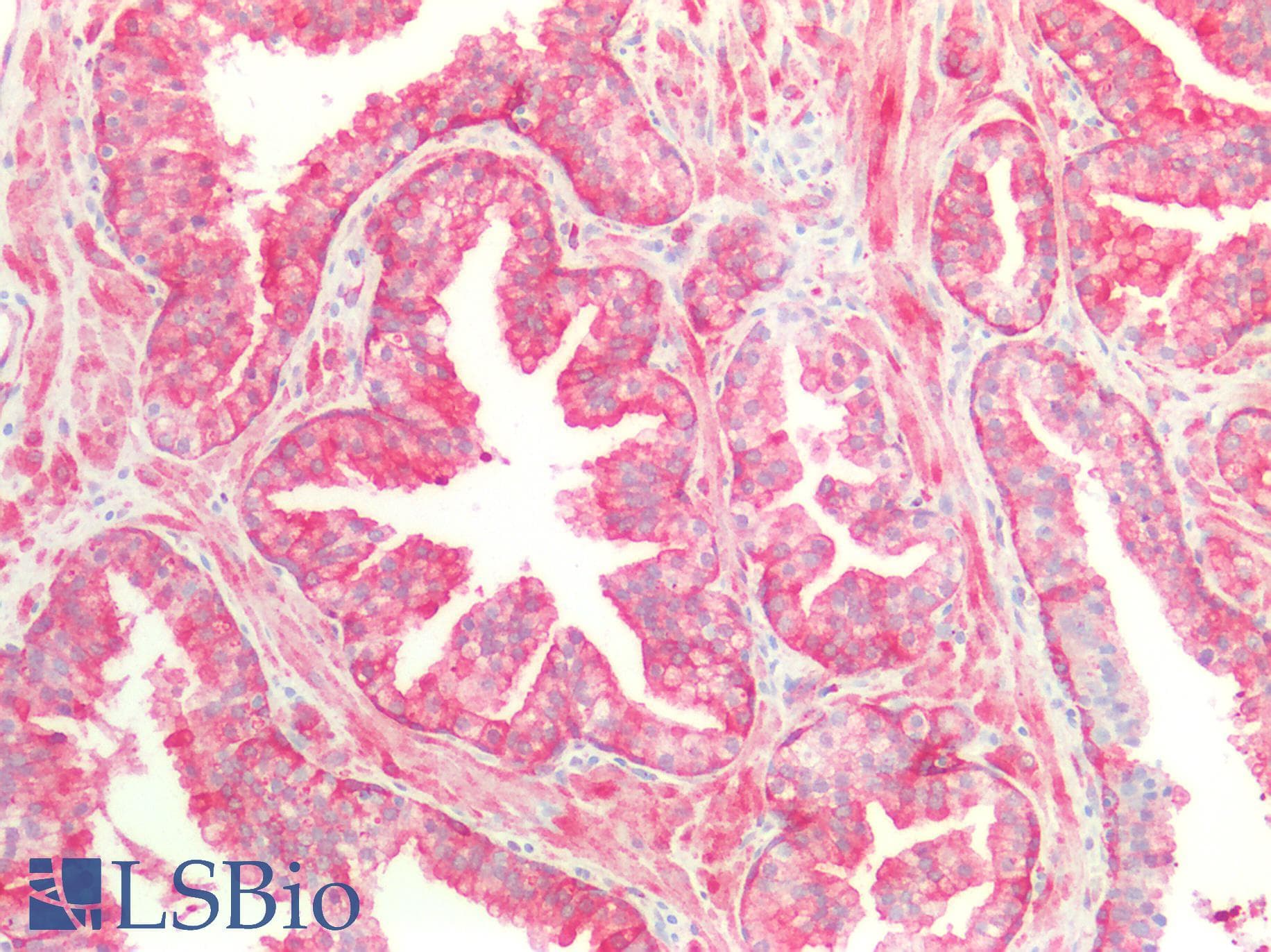 PathPlus™ Monoclonal Mouse anti-Human HSPB1 / HSP27 Antibody (IHC, WB)