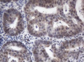 ACD / PTOP Antibody (clone OTI2B1)
