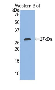 EDA / Ectodysplasin A Antibody (aa141-378, PE)