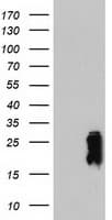 IHC-plus™ TAGLN / Transgelin / SM22 Antibody (clone 8C8)