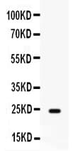 FGF1 / Acidic FGF Antibody