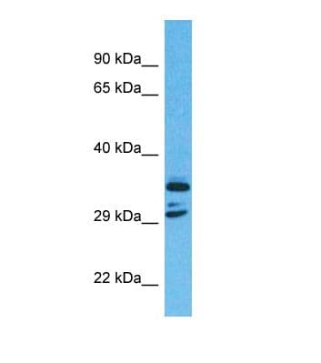 C11orf65 Antibody (aa104-153)