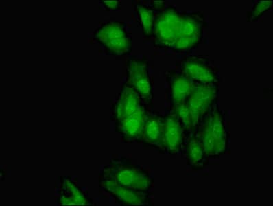 IHC-plus™ Polyclonal Rabbit anti-Human ELAVL2 / HUB Antibody (IHC, WB)