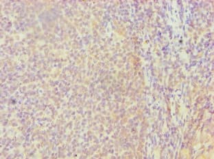 Polyclonal Rabbit anti-Human HBP17 / FGFBP1 Antibody (aa22-232, IHC, WB)
