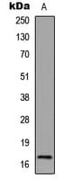 Polyclonal Rabbit anti-Human Histone H3 Antibody (Acetyl-Lys123, WB)