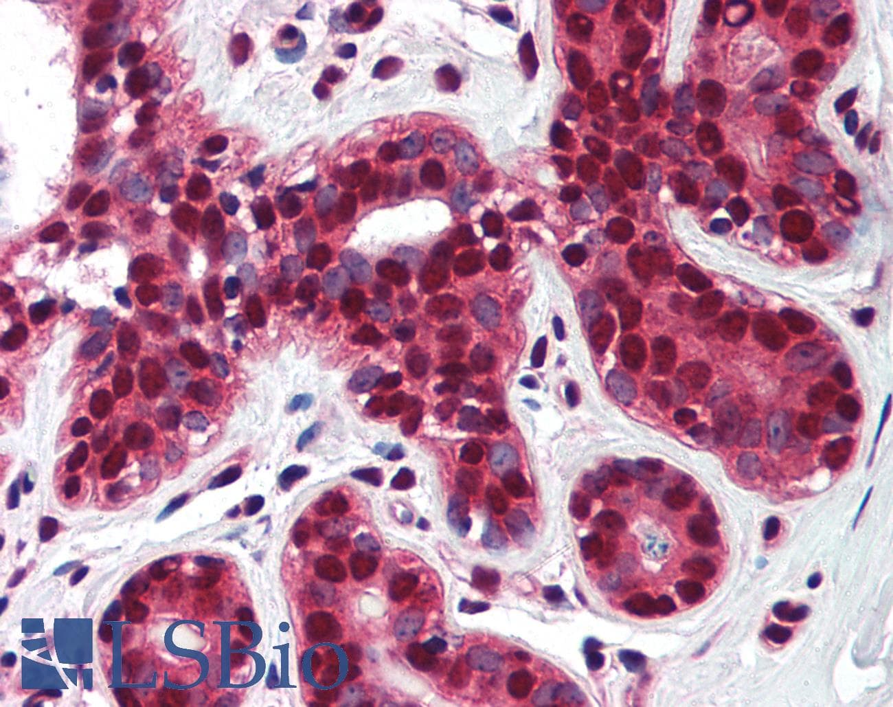 IHC-plus™ Polyclonal Rabbit anti-Human TP73 / p73 Antibody (aa75-125, IHC, WB)