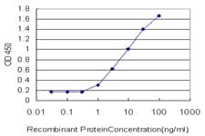 IHC-plus™ LDHB / Lactate Dehydrogenase B Antibody (clone 2H6)