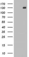 Monoclonal Mouse anti-Human PR / Progesterone Receptor Antibody (clone OTI7G7, aa1-298, WB)
