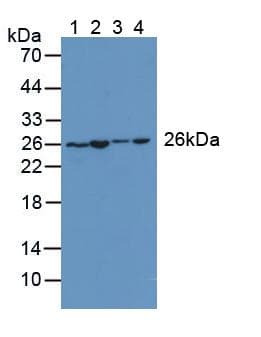 AK2 / Adenylate Kinase 2 Antibody (aa64-232, APC)