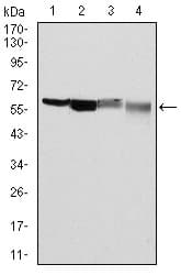 G6PD Antibody (clone 5E+12)