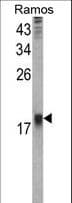 HR6B / UBE2B Antibody (aa117-146)
