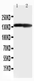 COL2A1 / Collagen II Alpha 1 Antibody (aa1222-1241)