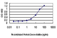 PathPlus™ Monoclonal Mouse anti-Human TFAP2A / AP-2 Antibody (clone 2G5, IHC, WB)