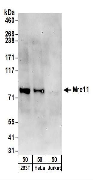 Polyclonal Rabbit anti-Human MRE11A / MRE11 Antibody (aa658-708, IHC, WB)