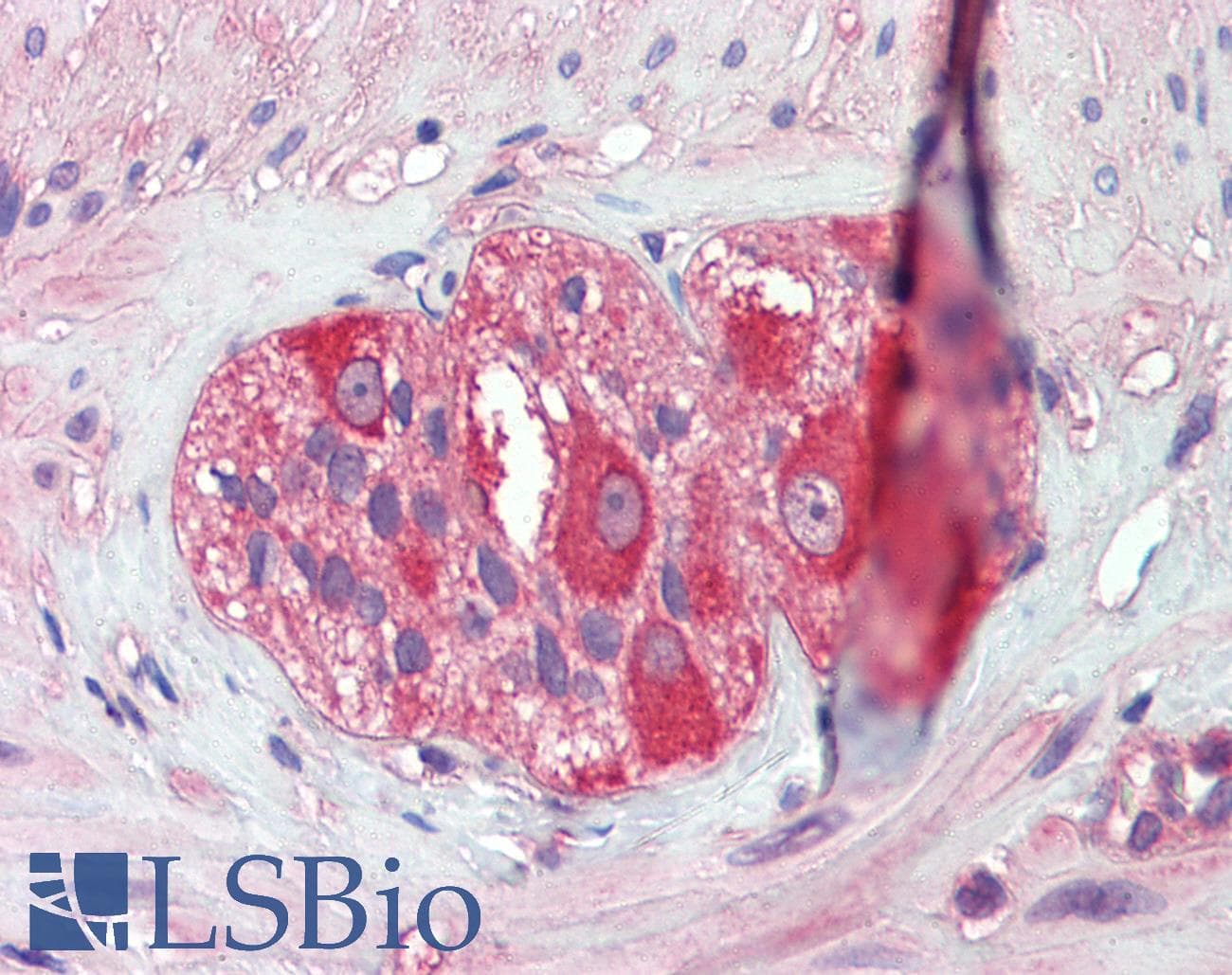 IHC-plus™ Polyclonal Rabbit anti-Human HSP90 / Heat Shock Protein 90 Antibody (aa250-325, IHC, WB)
