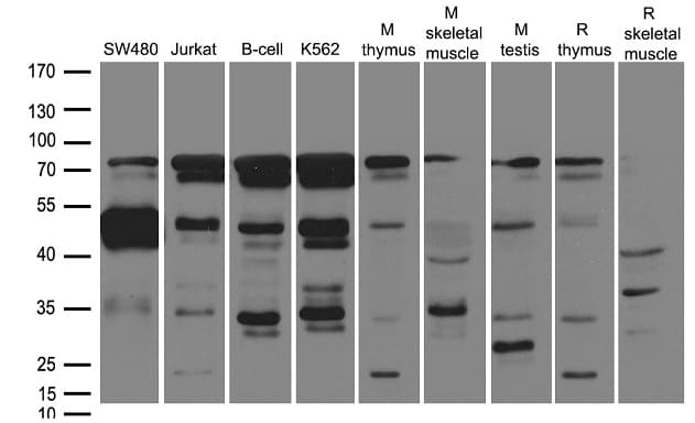 SOCS1 Antibody