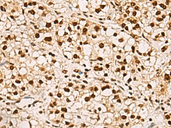 Polyclonal Rabbit anti-Human ELF5 Antibody (IHC)