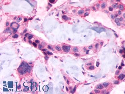 PathPlus™ Polyclonal Rabbit anti-Human LPAR6 / P2RY5 / P2Y5 Antibody (C-Terminus, IHC)