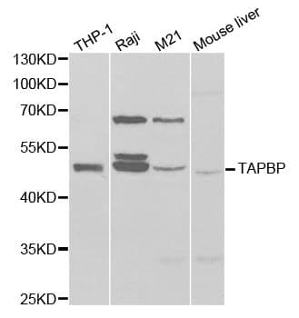 TAPBP / Tapasin Antibody