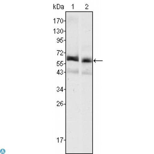 AFP Antibody