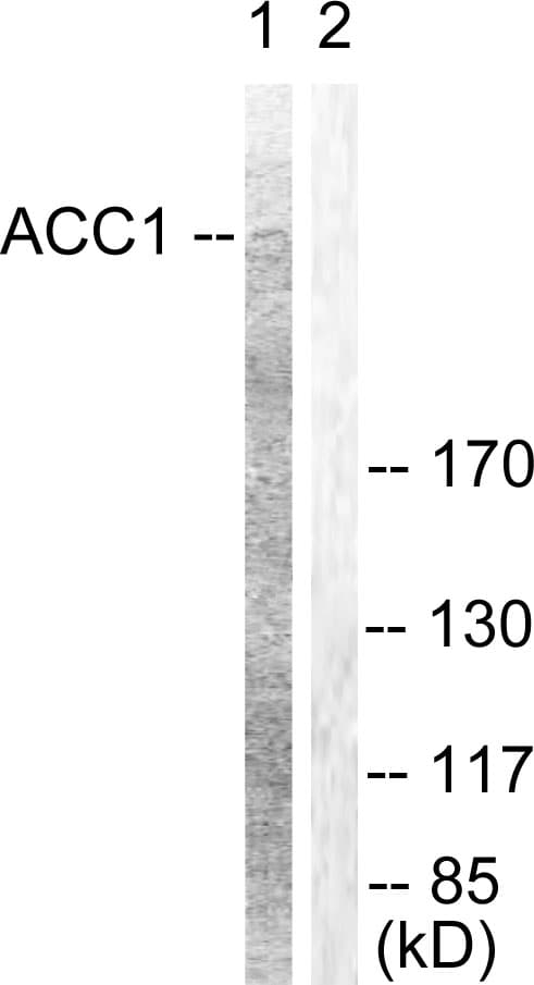 Acetyl-CoA Carboxylase / ACC Antibody (aa46-95)