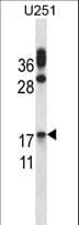 CGB / hCG Beta Antibody (aa63-90)