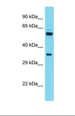 Polyclonal Rabbit anti-Human C15orf41 Antibody (aa67-116, WB)