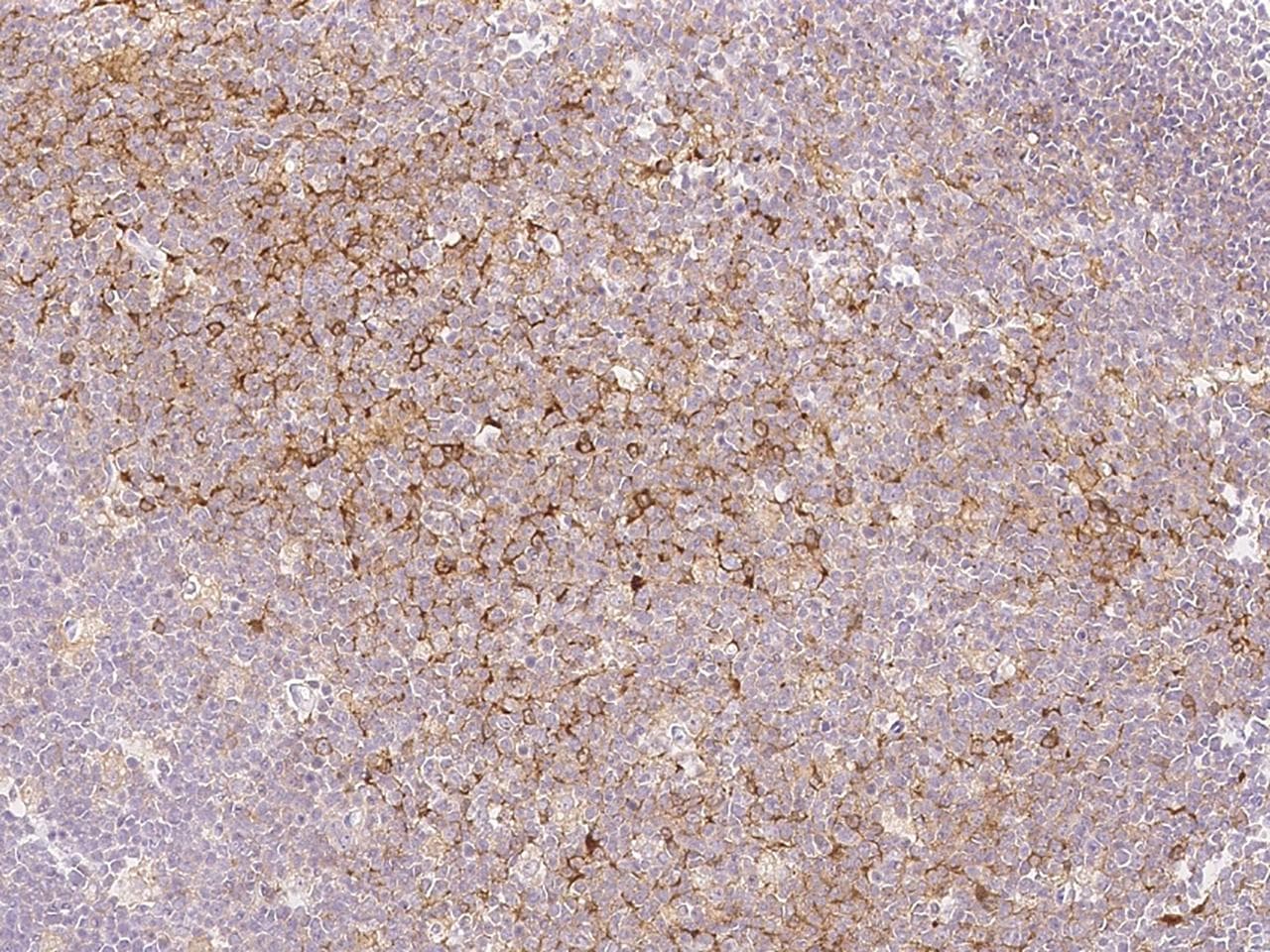 SAMSN1 Antibody