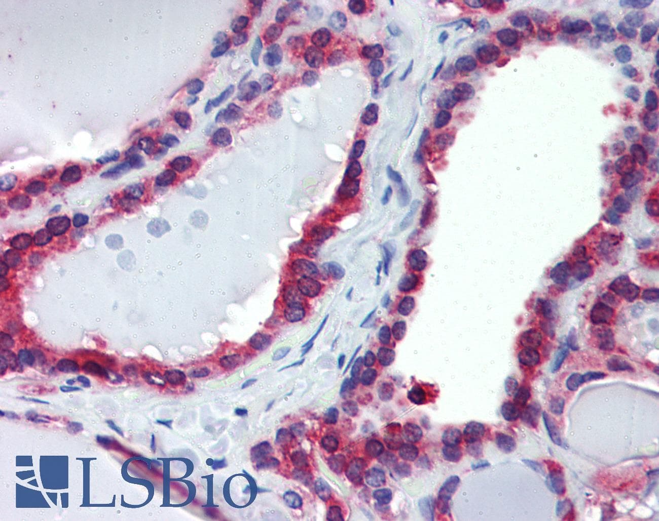 IHC-plus™ CANX / Calnexin Antibody