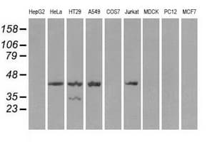 PRKAR1A Antibody (clone OTI6C7)