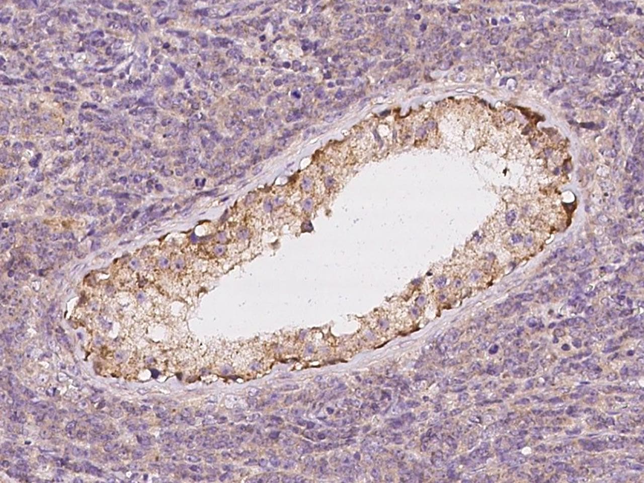 Polyclonal Rabbit anti-Human USP32 Antibody (IHC)