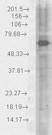IHC-plus™ HSP70 / Heat Shock Protein 70 Antibody