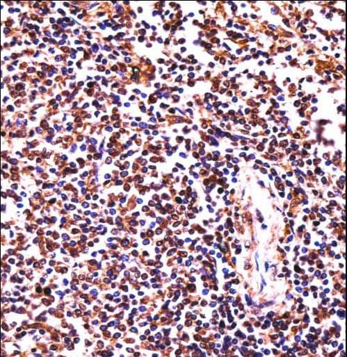 Polyclonal Rabbit anti-Human HCLS1 Antibody (aa362-391, IHC, WB)