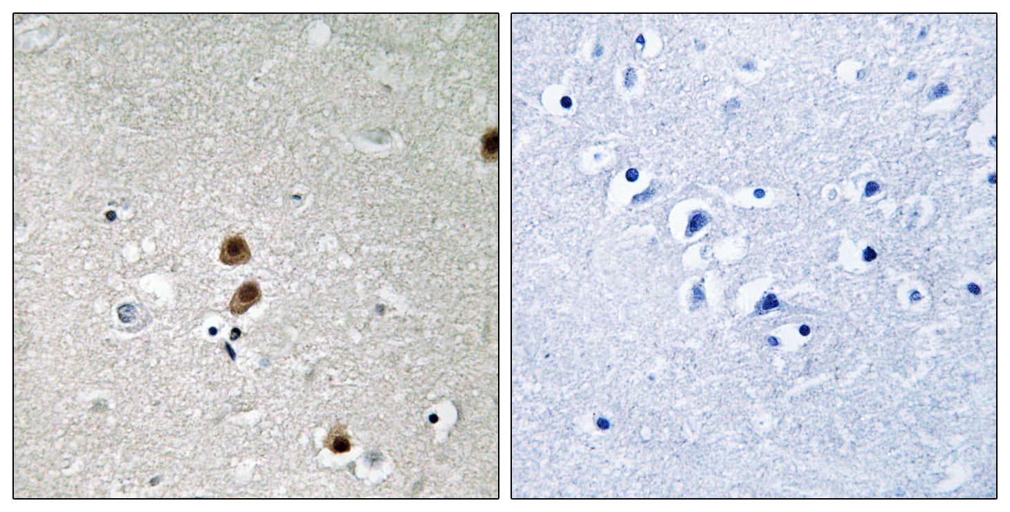 CTBP1 / CTBP Antibody (phospho-Ser422)