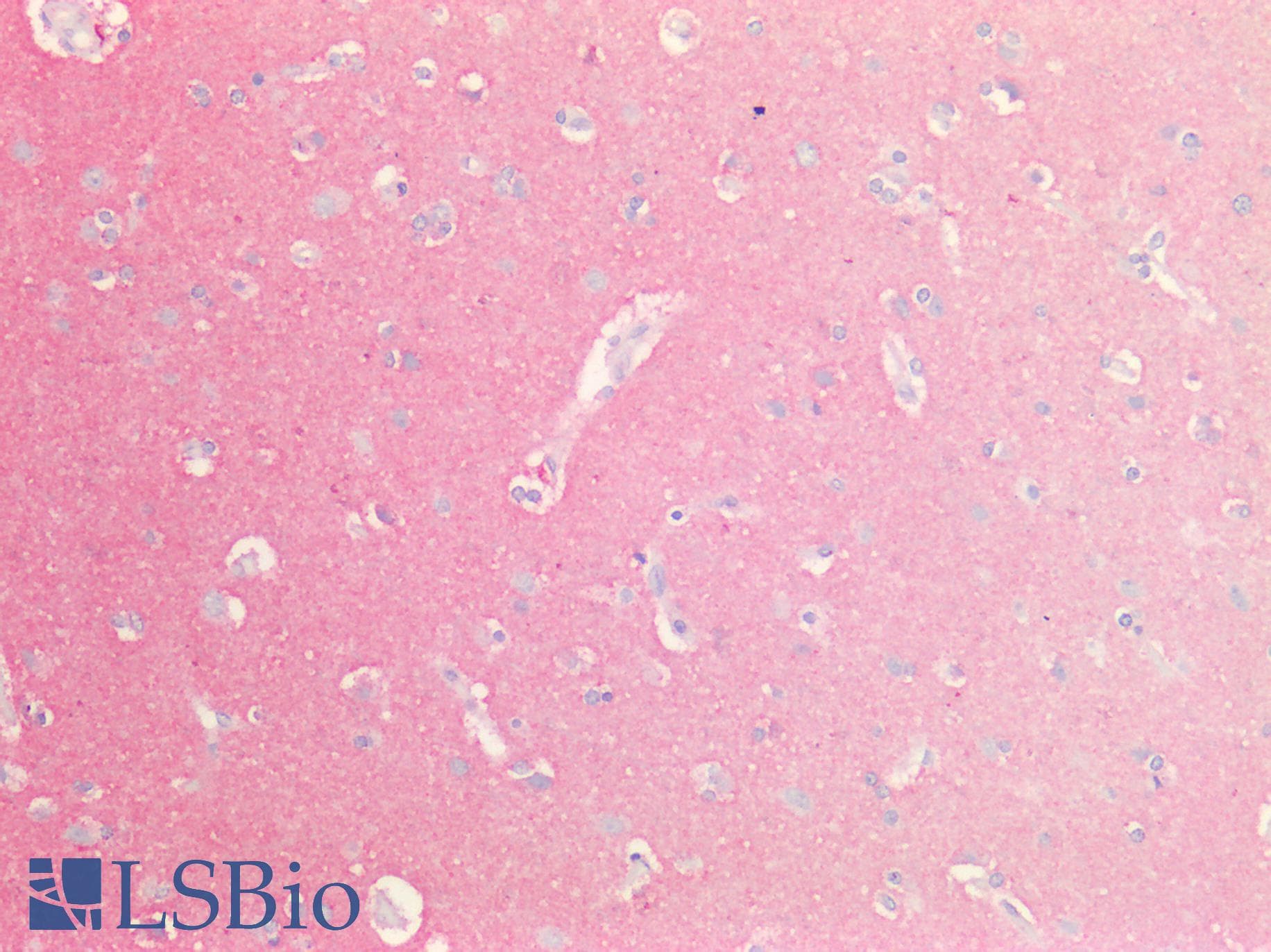 PathPlus™ Polyclonal Rabbit anti-Human GNAQ Antibody (IHC)