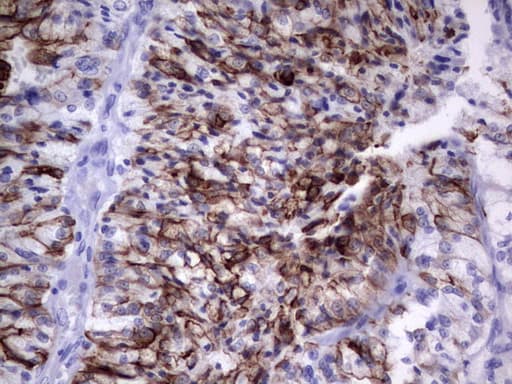 Monoclonal Mouse anti-Human KRT19 / CK19 / Cytokeratin 19 Antibody (clone OTI1E7, aa240-390, IHC)