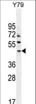 Polyclonal Rabbit anti-Human LACE1 Antibody (aa68-96, WB)