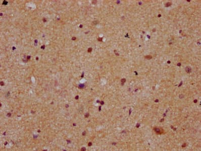 MEX3B / RKHD3 Antibody