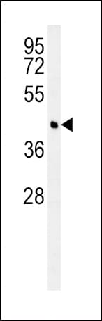 Polyclonal Rabbit anti-Human BCAT1 / ECA39 Antibody (aa81-107, IHC, WB)