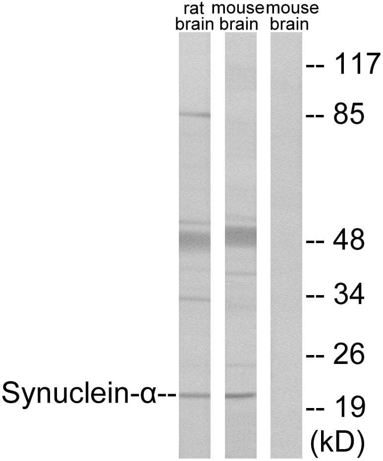 SNCA / Alpha-Synuclein Antibody (p125)