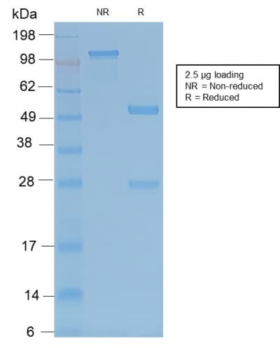 Recombinant Monoclonal Rabbit anti-Human ACP5 / TRAP Antibody (clone ACP5/2336R, IHC)