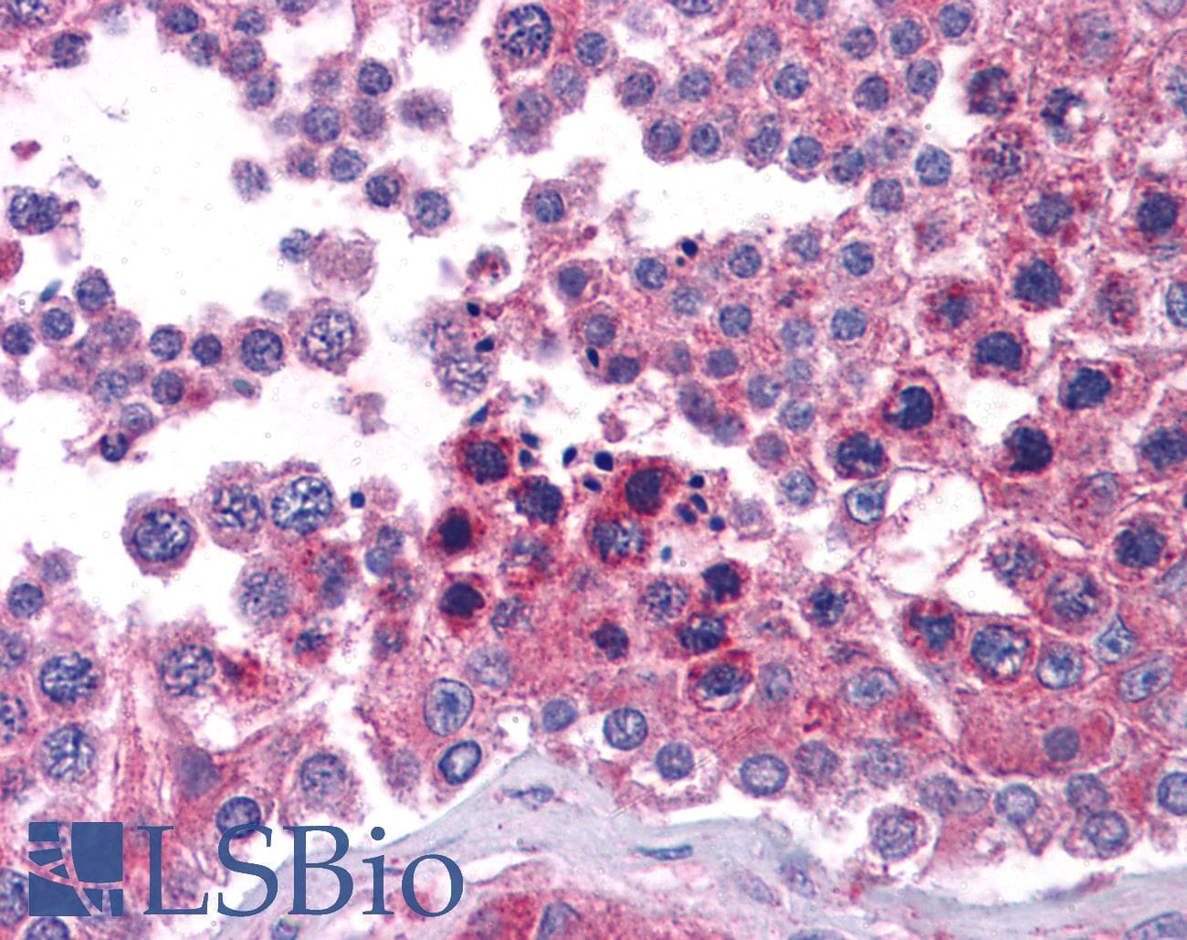 Polyclonal Rabbit anti-Human STAT6 Antibody (aa614-663, IHC, WB)
